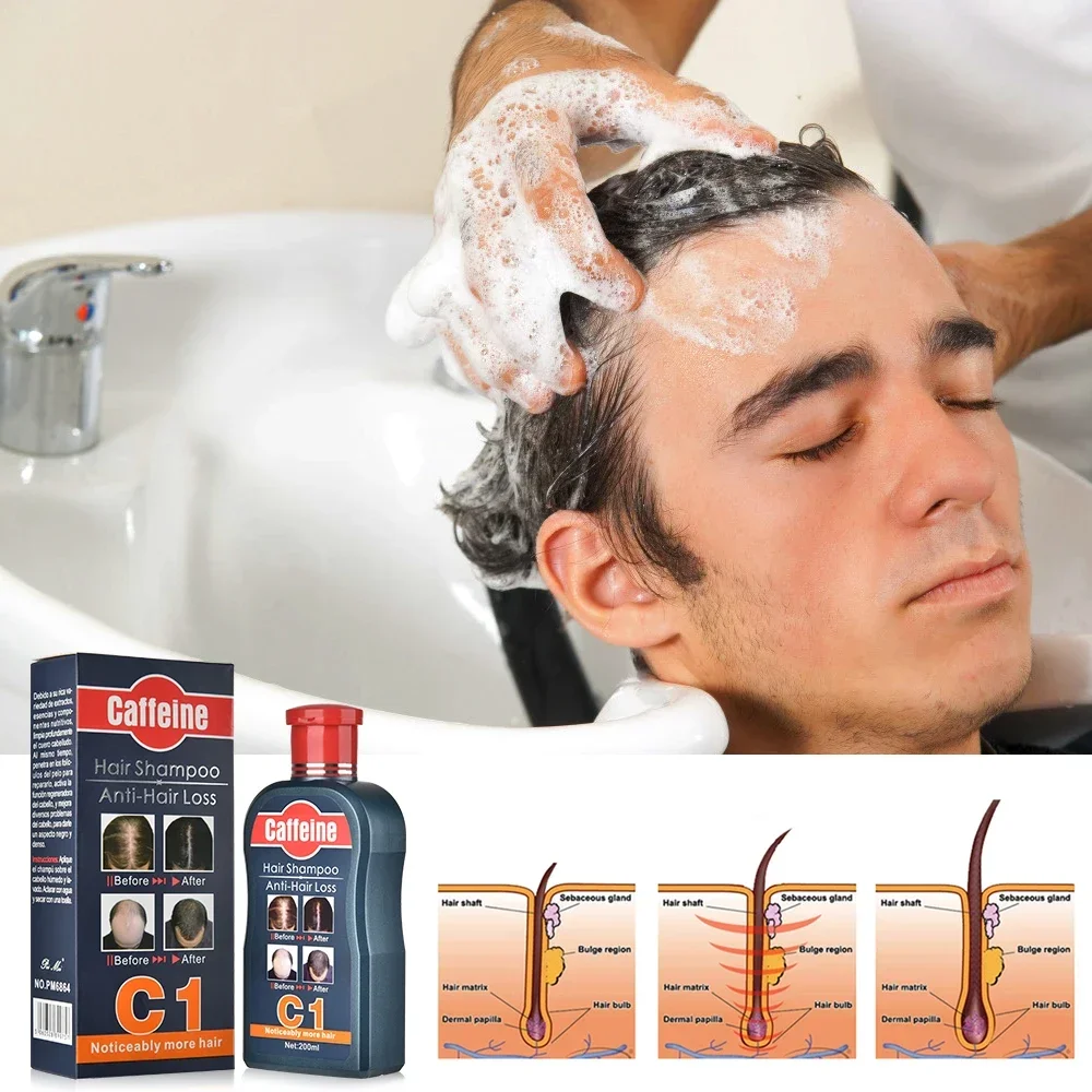Men Shampoo For Hair Growth Na - Hair Care Korean Products 评论和价格